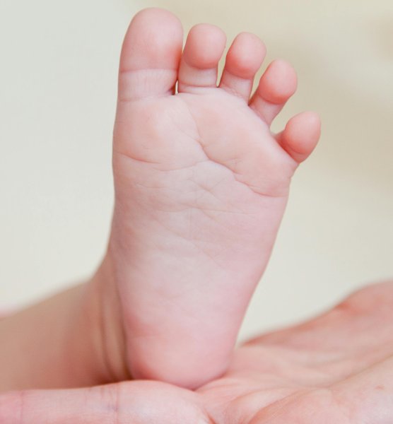 Příznaky kožní dermatitidy a 10 tipů, jak se jí zbavit 2